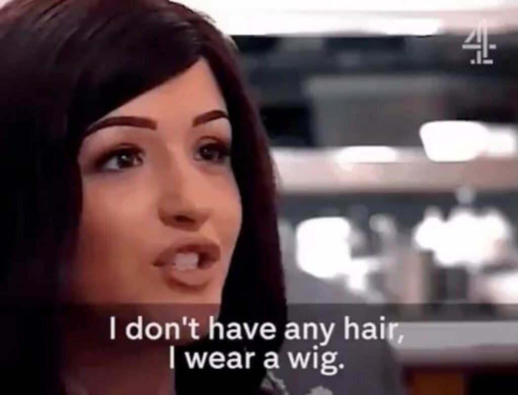 かつらを着用していると話す女性